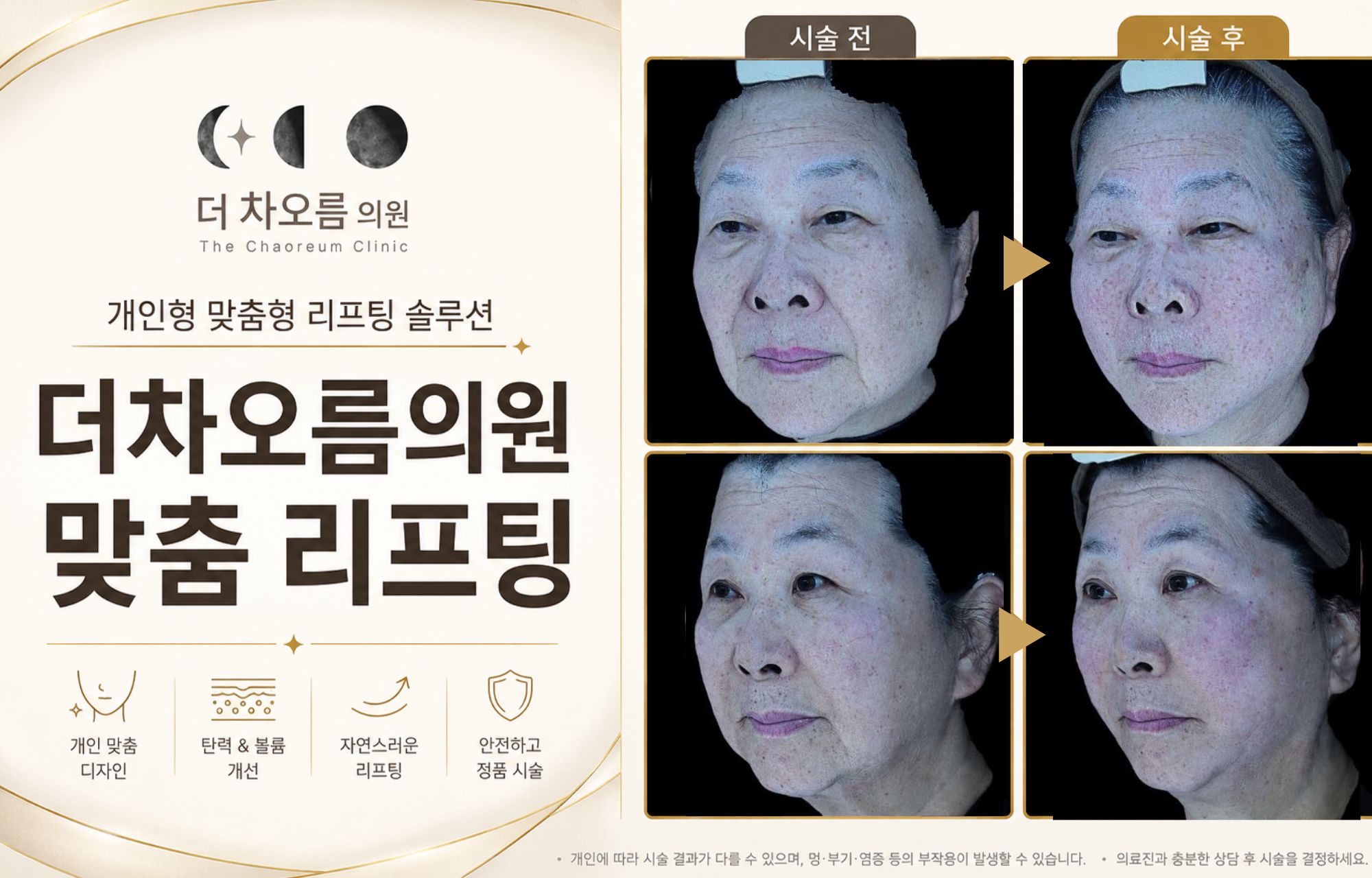 팝업이미지
